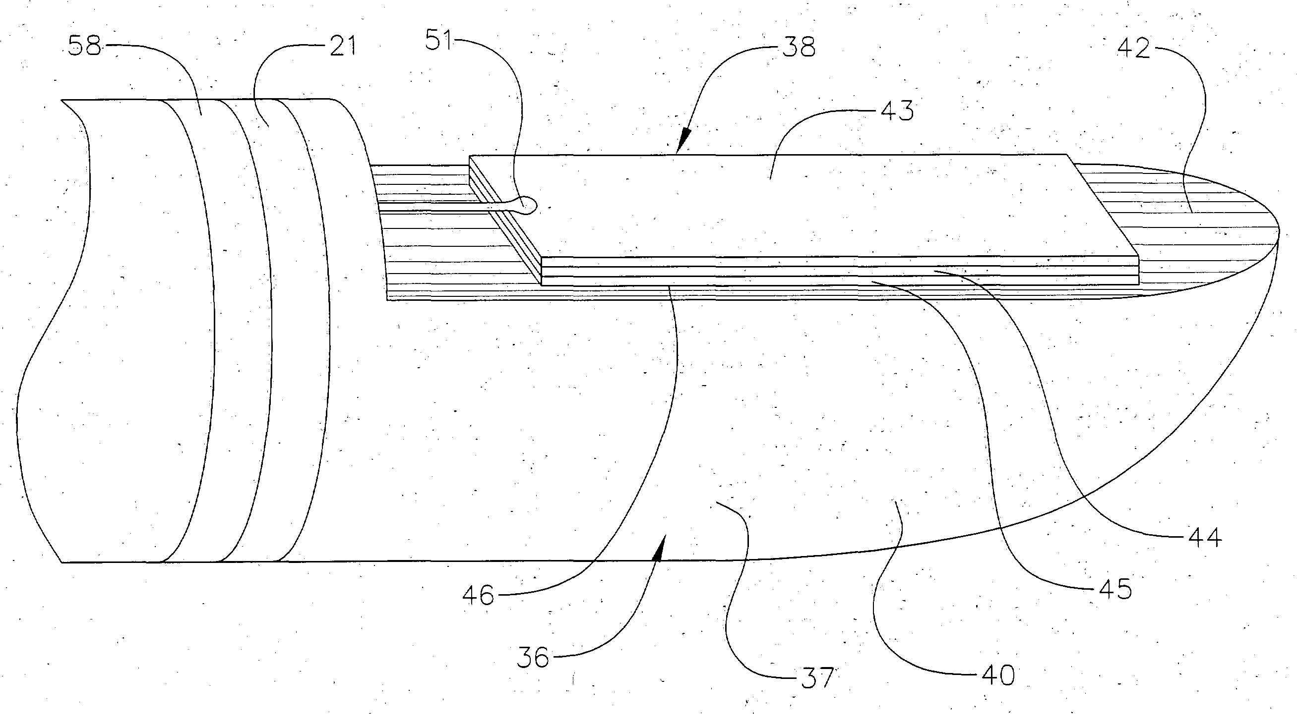 Ultrasound ablation catheter and method for its use