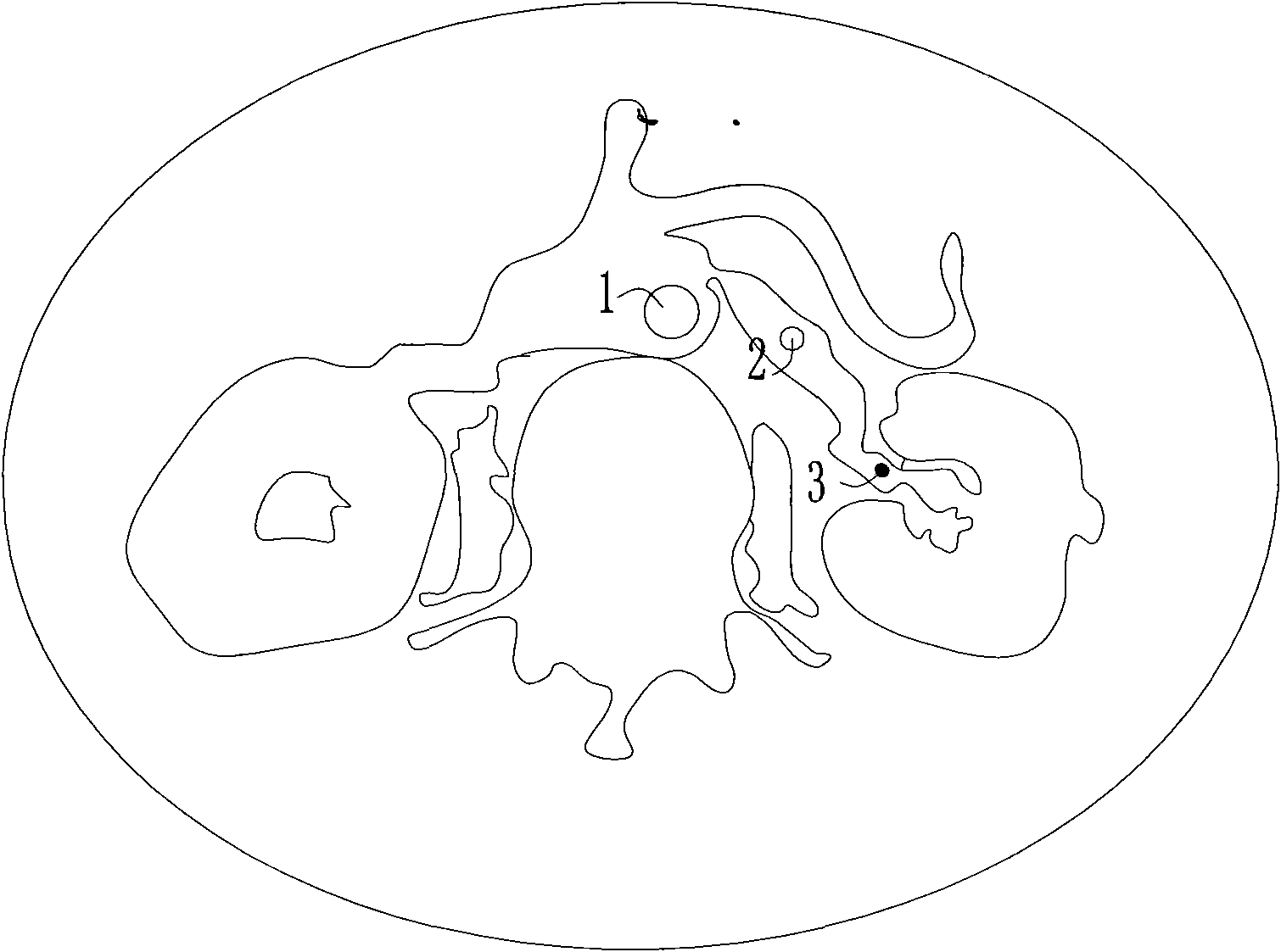 Method for measuring blood circulation time of kidney by CT (computerized tomography) tracking and scanning