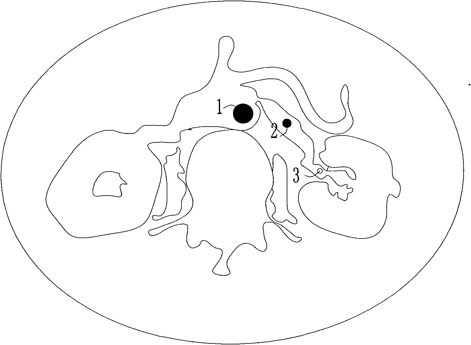 Method for measuring blood circulation time of kidney by CT (computerized tomography) tracking and scanning