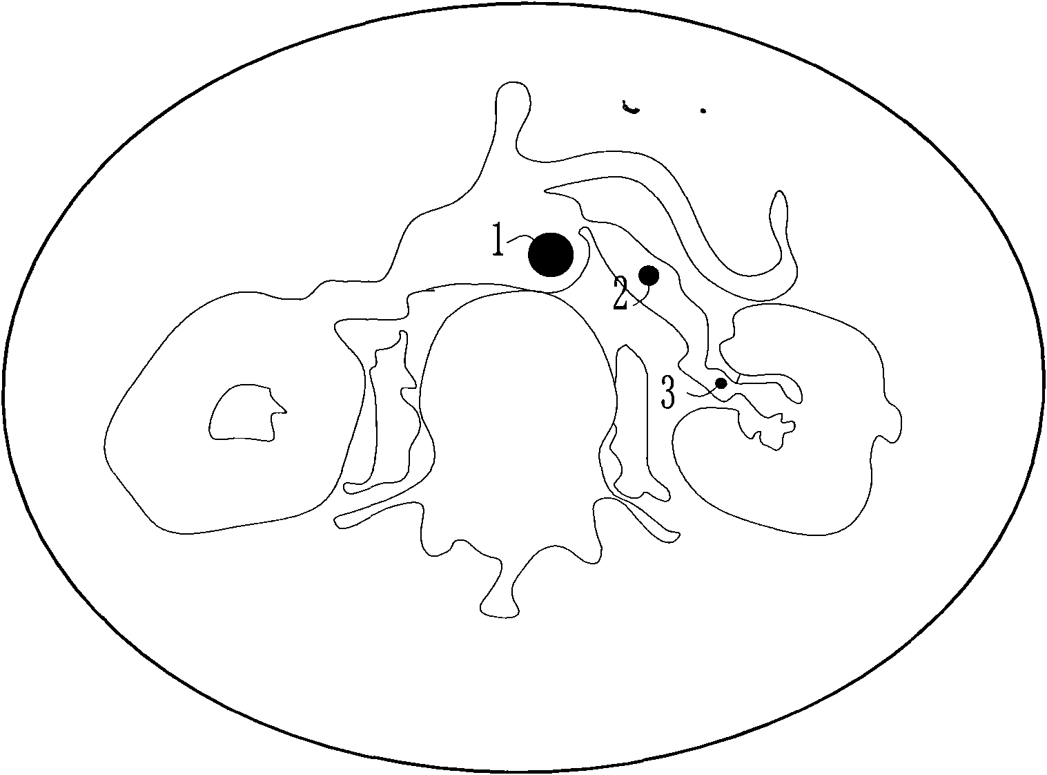 Method for measuring blood circulation time of kidney by CT (computerized tomography) tracking and scanning