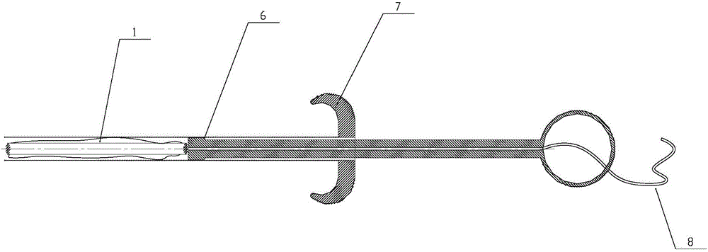 Minimal-invasion surgical fetching system capable of smashing specimen by pneumoperitoneum