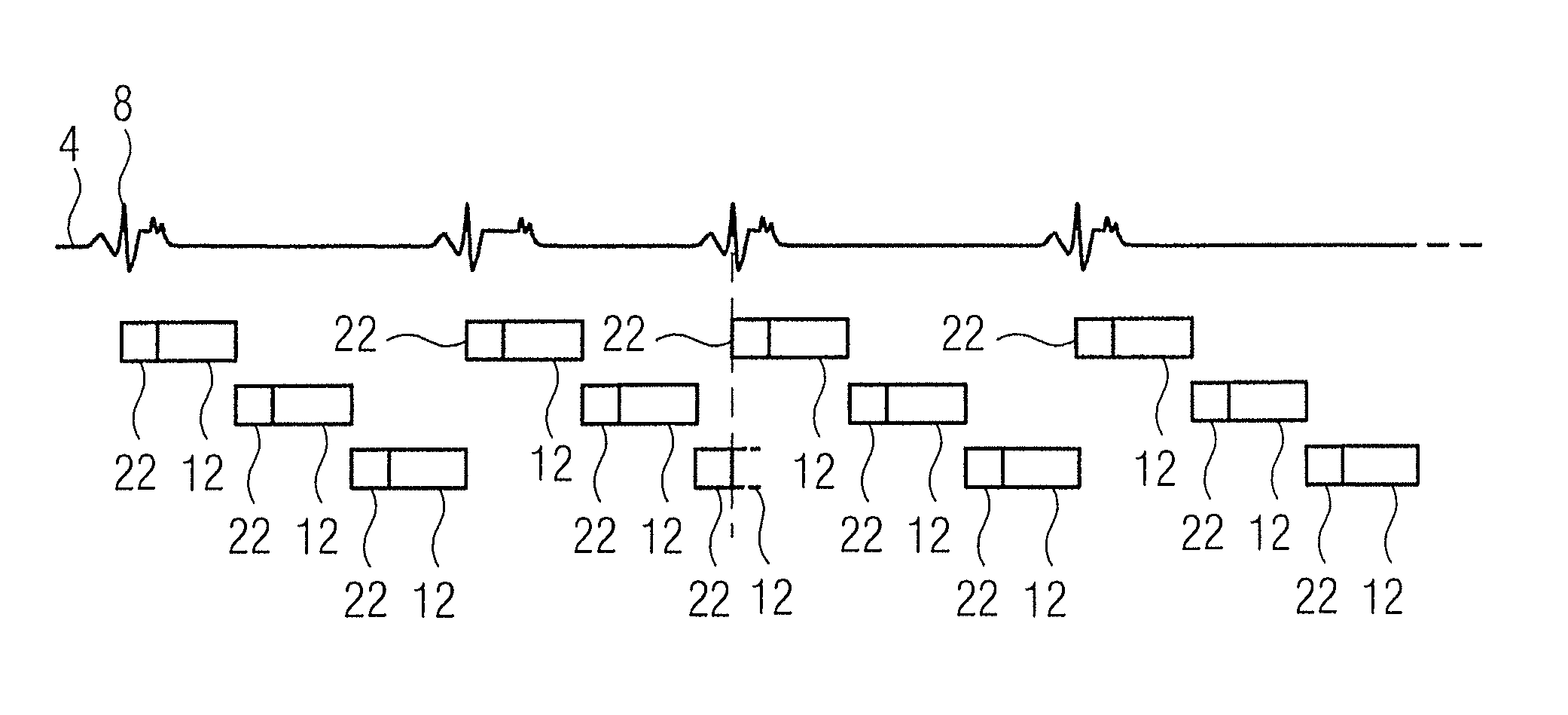 Method and magnetic resonance tomography apparatus for triggered acquisition of magnetic resonance data