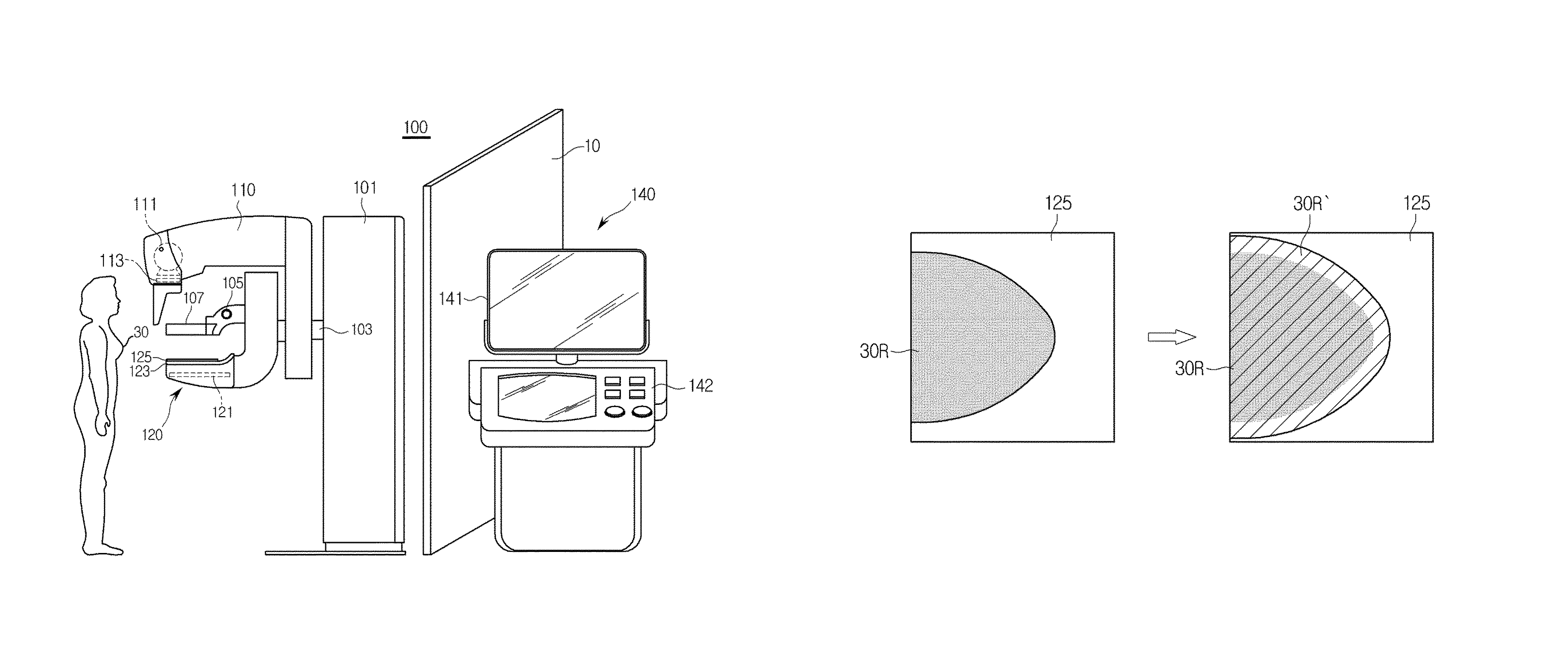 X-ray imaging apparatus and control method therefor