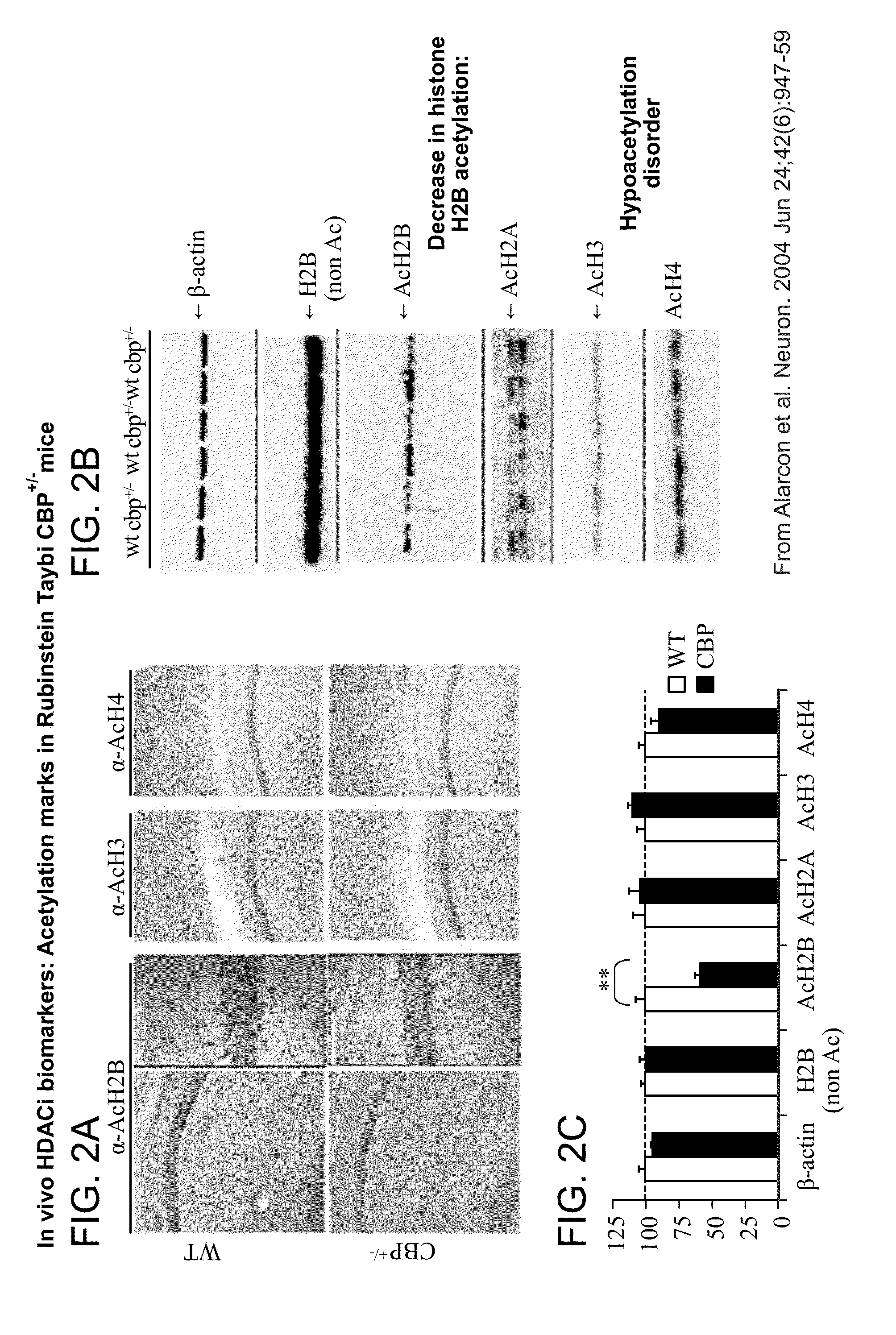 Use of ci-994 and dinaline for the treatment of memory/cognition and anxiety disorders