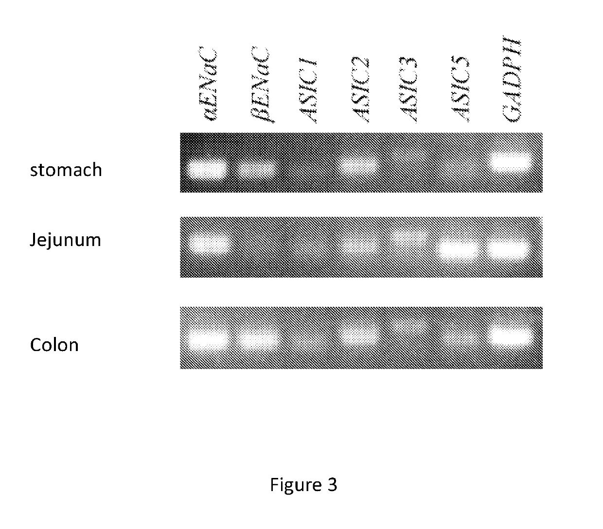 Methods and compositions for appetite control and weight management