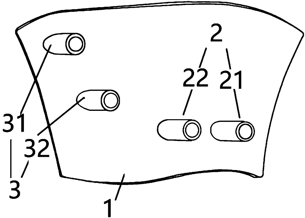 Construction method of high tibial osteotomy guide plate model