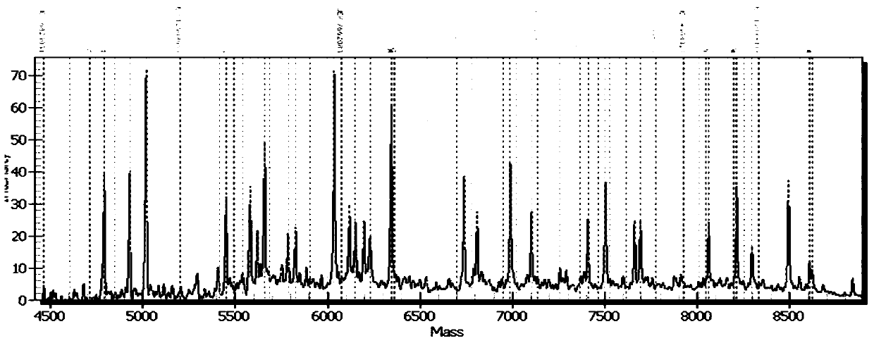 Detection product for differentiating enalapril individualized medication types