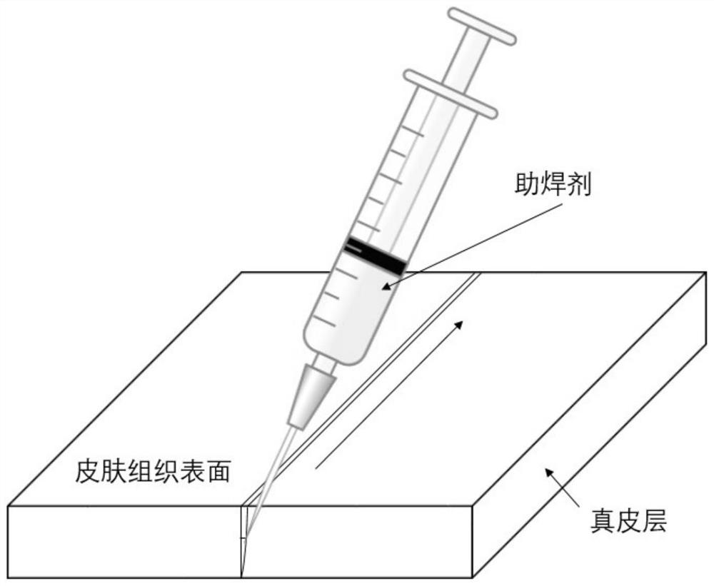 Laser biological tissue welding and suturing method with energy targeted regulation