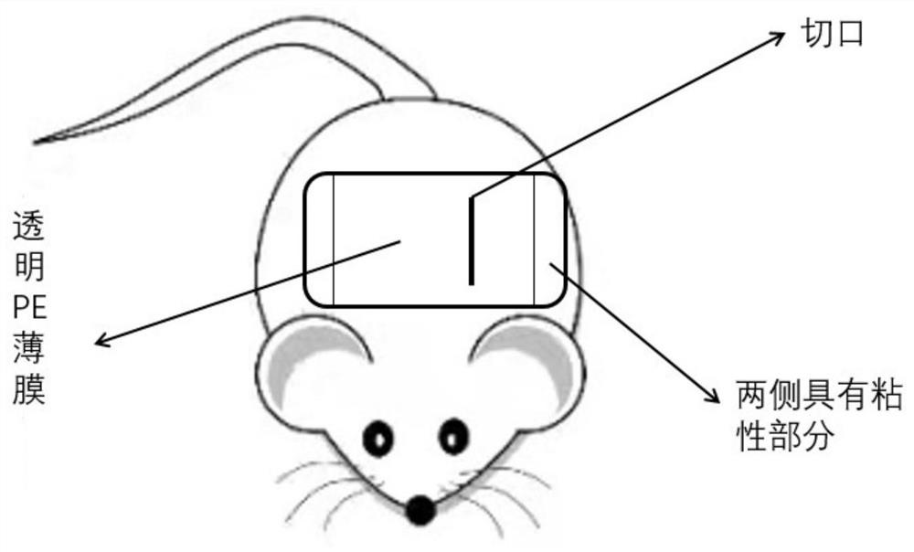 Laser biological tissue welding and suturing method with energy targeted regulation