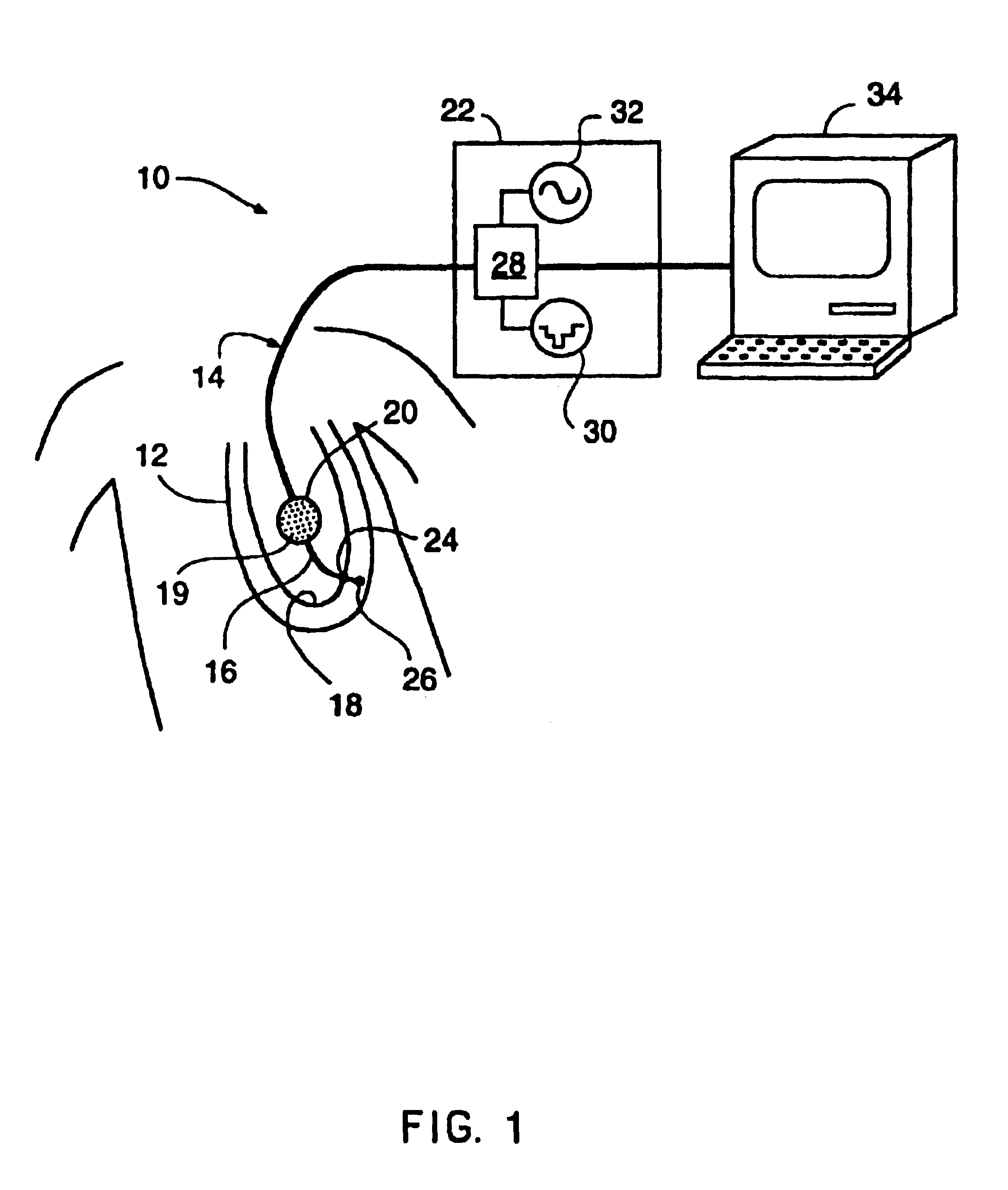 Endocardial mapping system