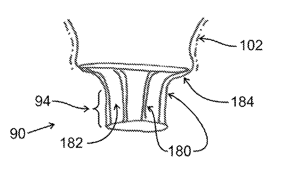 Transcatheter Mitral Valve Replacement Apparatus