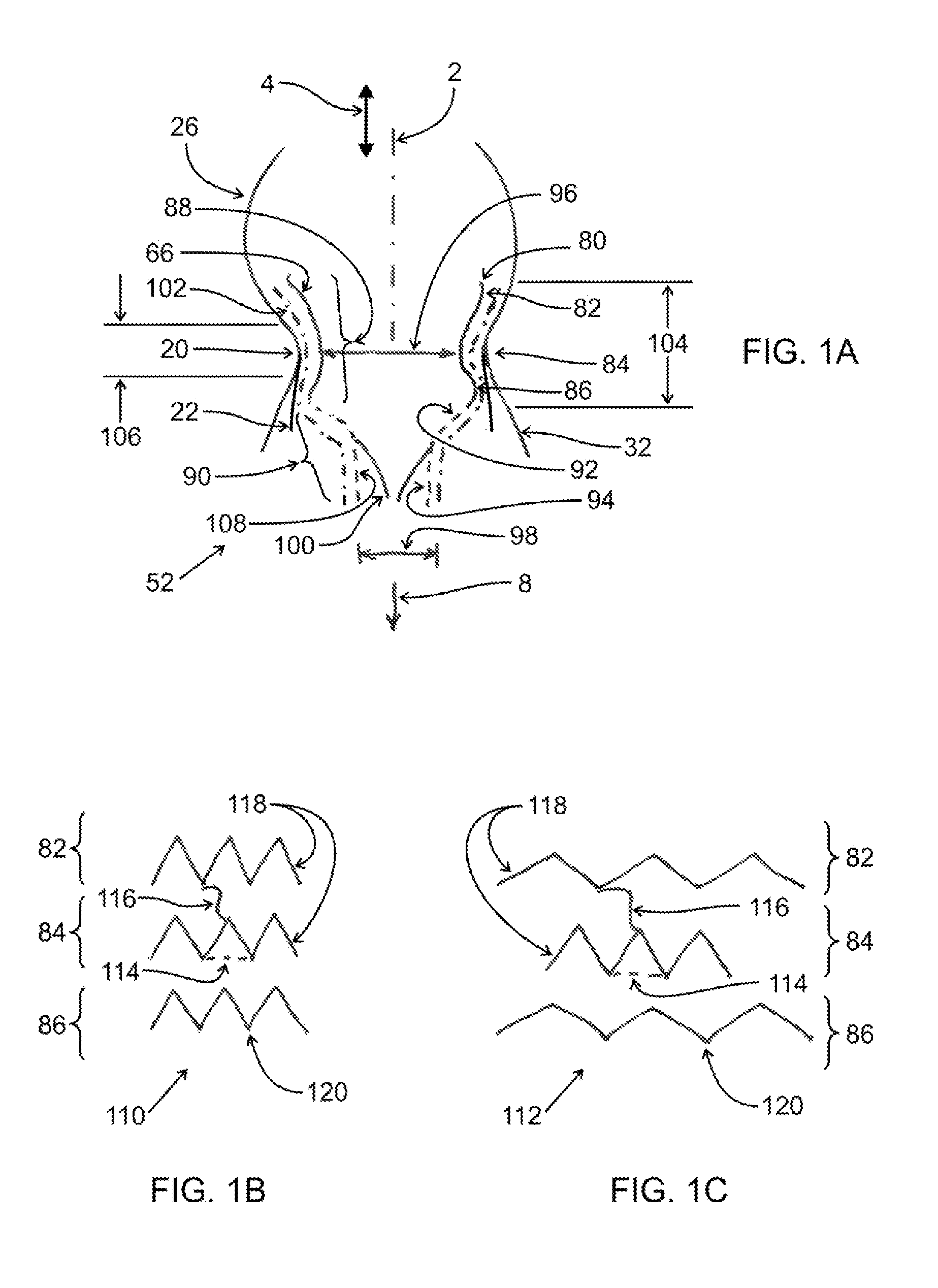 Transcatheter Mitral Valve Replacement Apparatus