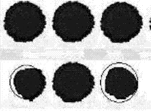 Blood cake specimen collecting and treating method and collection card dry blood cake DNA (deoxyribose nucleic acid) extracting method thereof