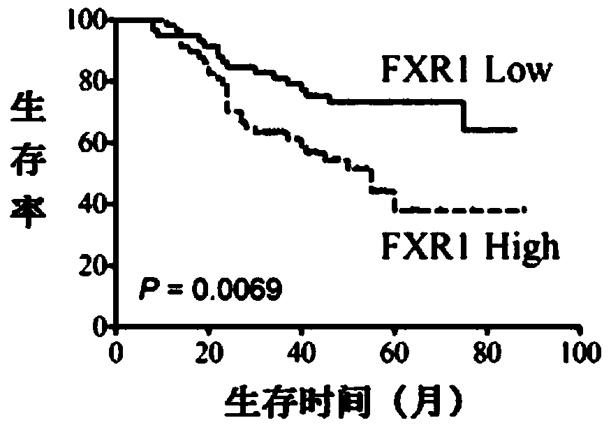 A molecular marker for esophageal cancer and uses thereof