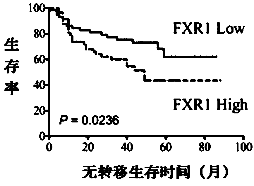 A molecular marker for esophageal cancer and uses thereof