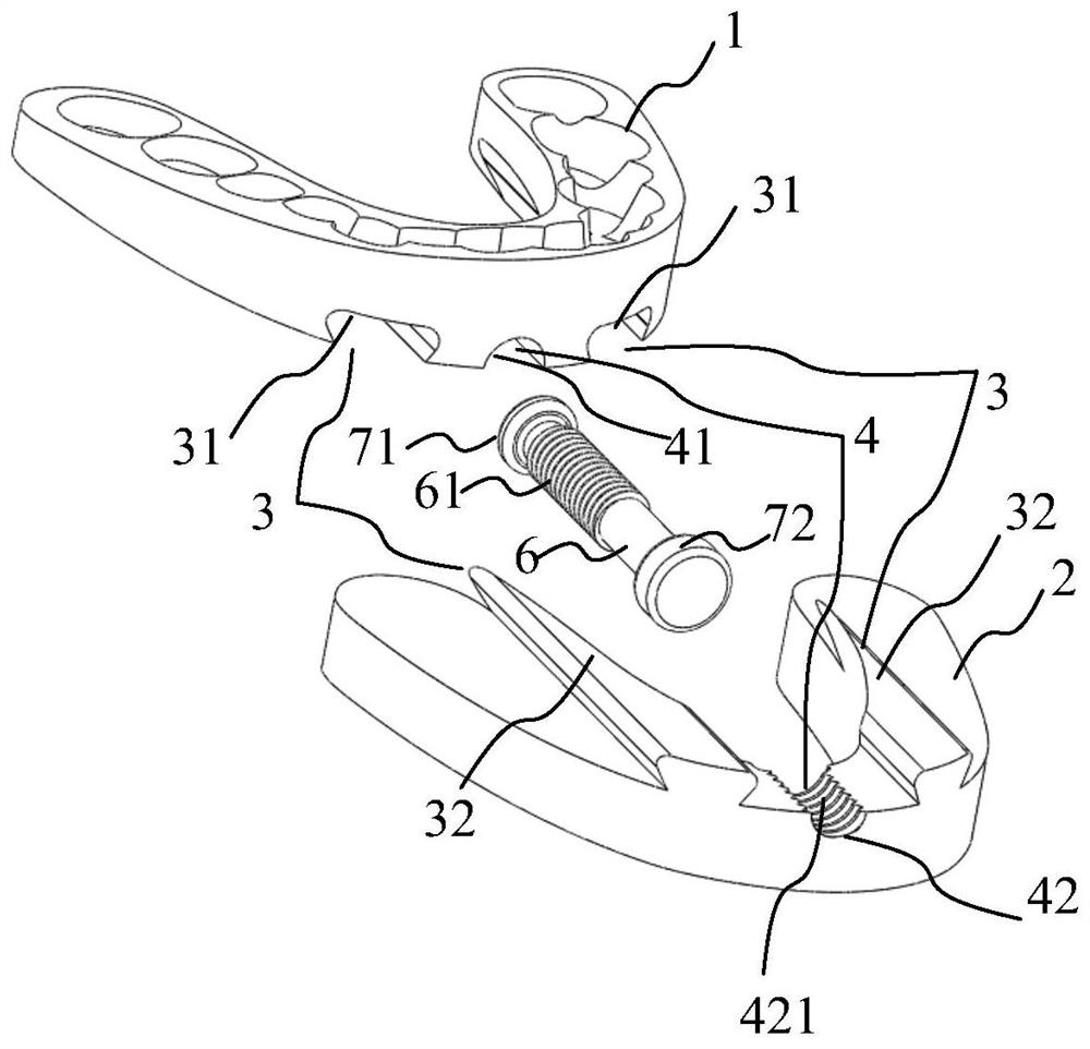 Digitized mandibular protraction auxiliary training device and construction method thereof