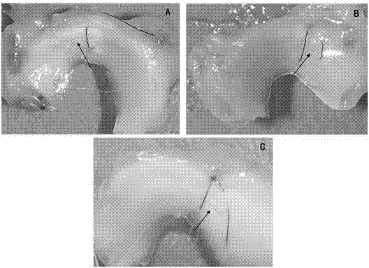 Tissue engineering meniscus repair sheet and preparation method thereof