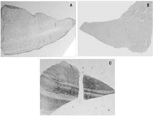 Tissue engineering meniscus repair sheet and preparation method thereof