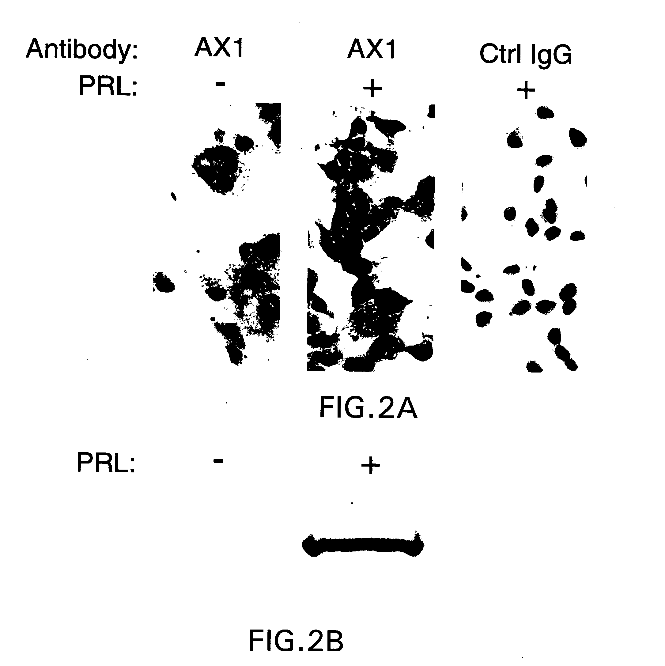 Diagnostic and monitoring methods for cancer