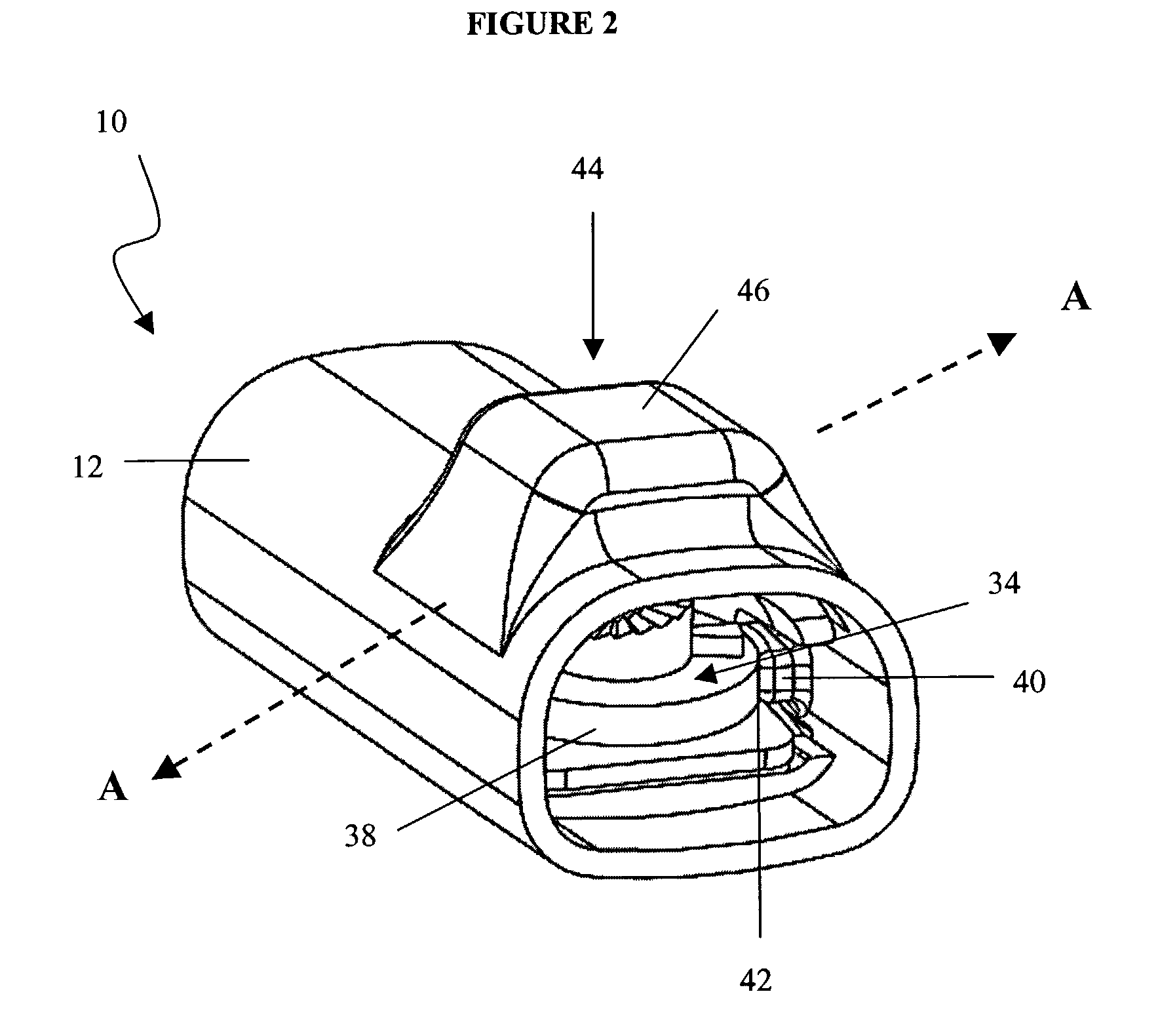 Shunt valve locking mechanism