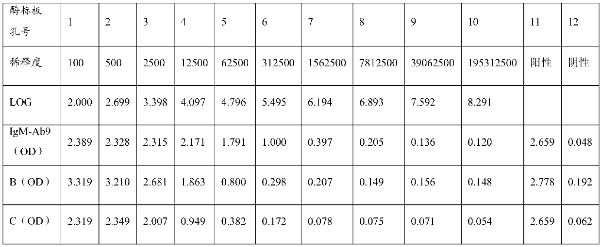 Anti-human igm monoclonal antibody, its hybridoma cell line and application