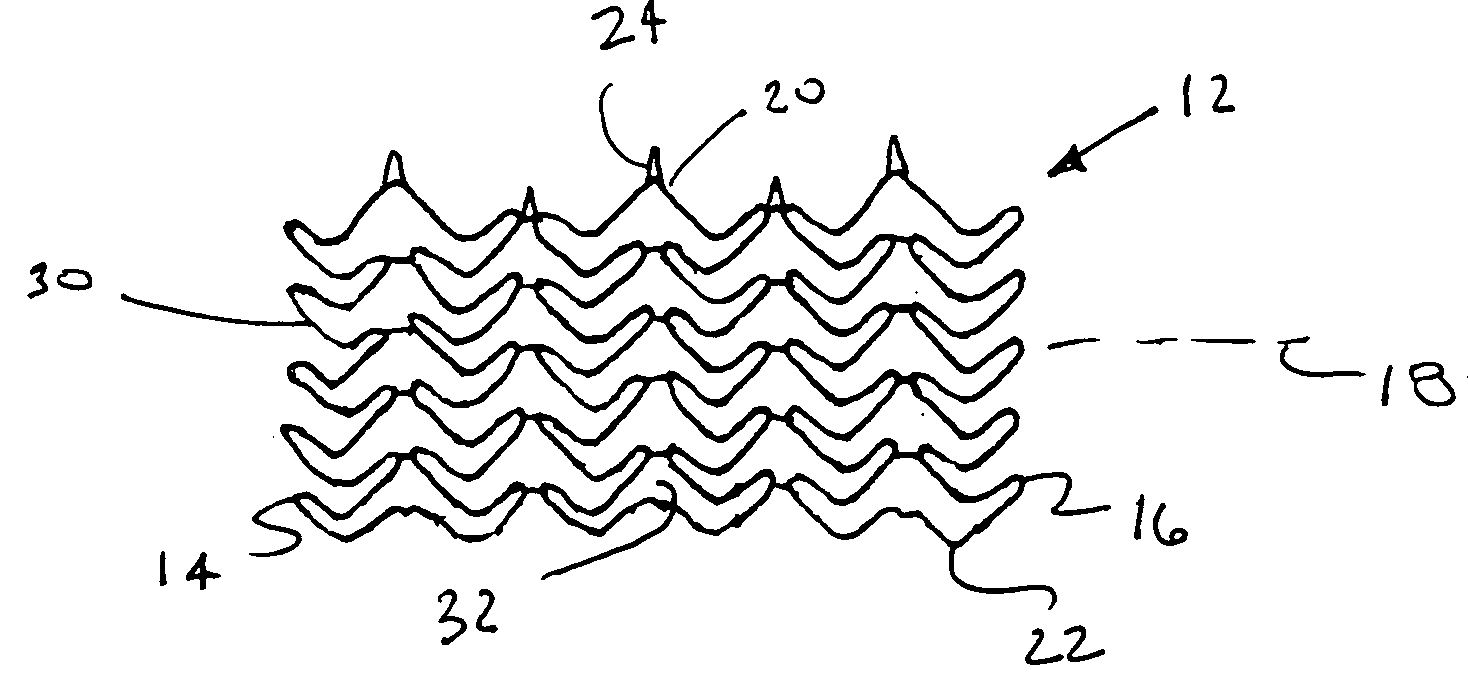 Flexible, stretchable coiled-sheet stent