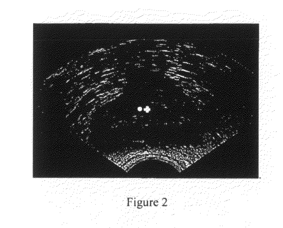 Method for automatic boundary segmentation of object in 2d and/or 3D image