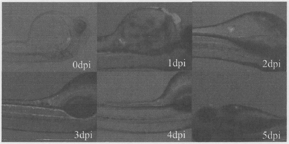 Method for quantitatively evaluating proliferation of tumor cells transplanted into zebra fish embryos