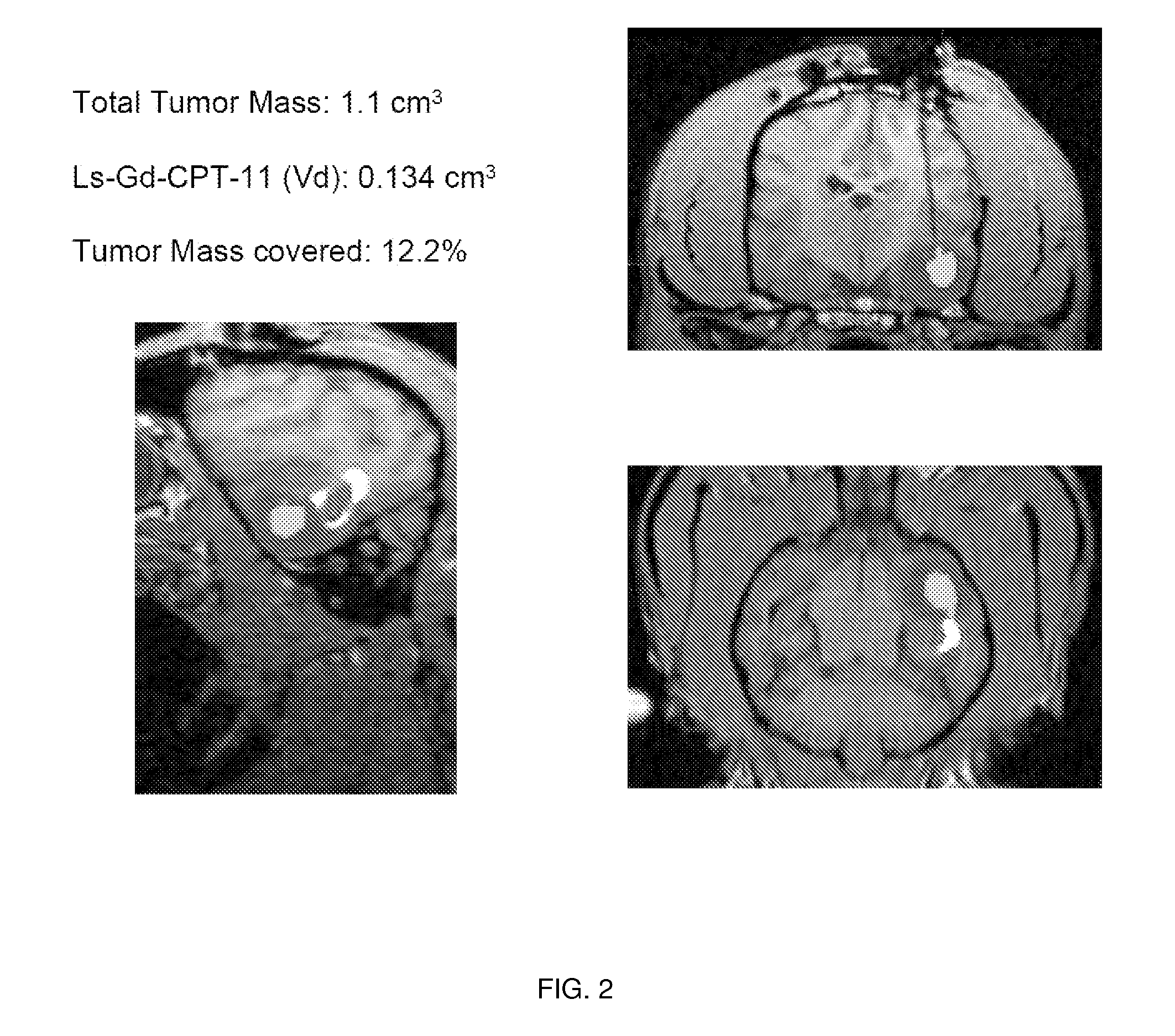 Compositions and Methods for Convection Enhanced Delivery of High Molecular Weight Neurotherapeutics