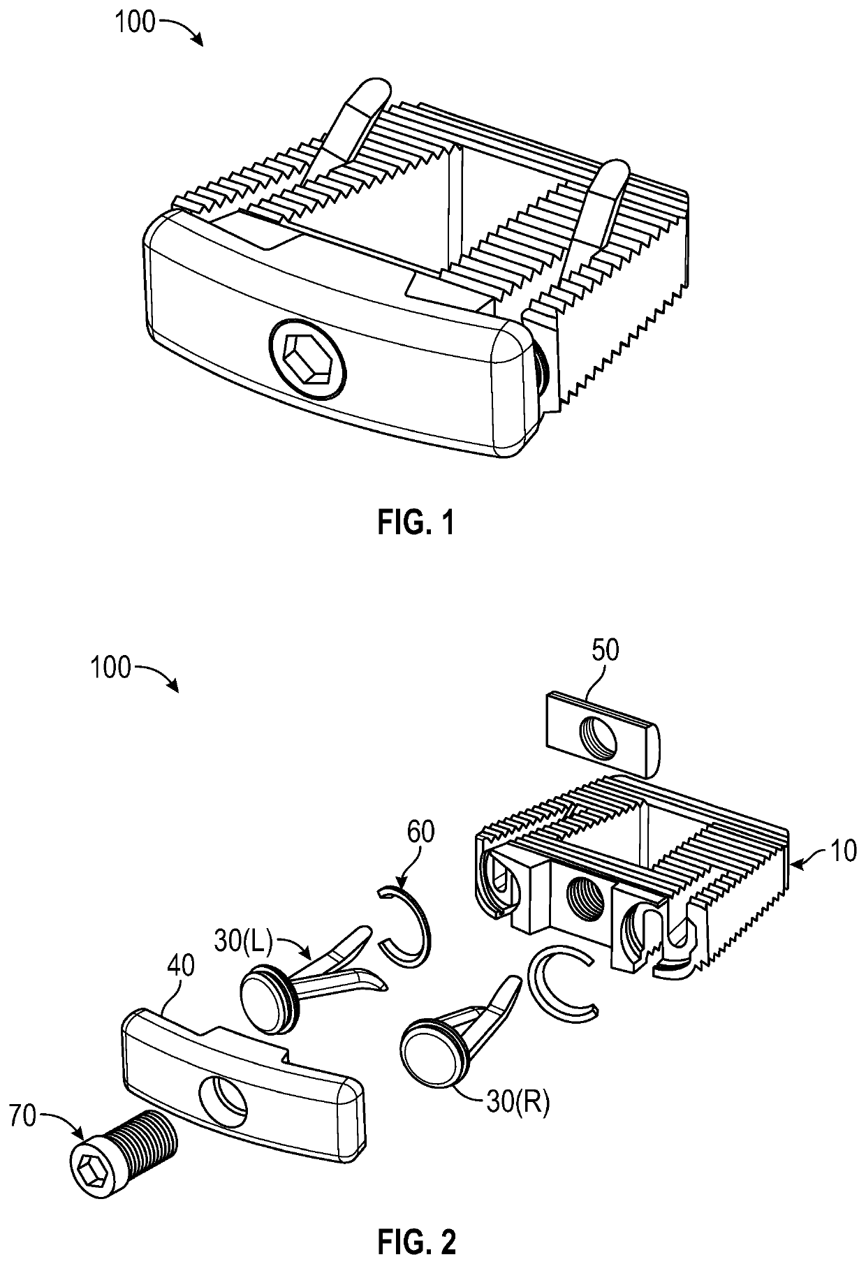 Intervertebral implant and method of use