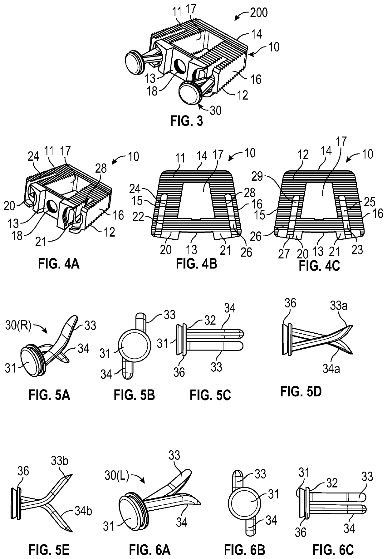 Intervertebral implant and method of use