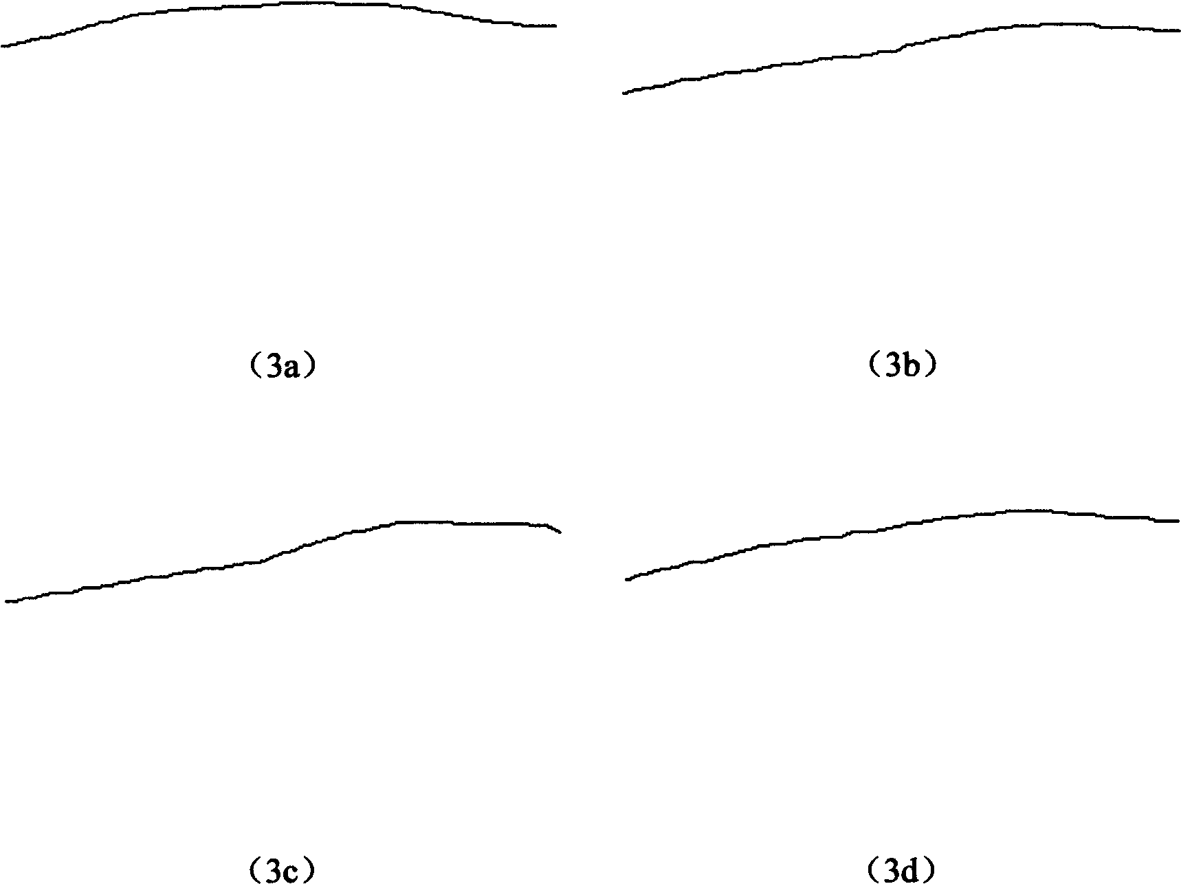 Method for generating digitization breath gate-control signal based on abdomen body-surface skeleton line