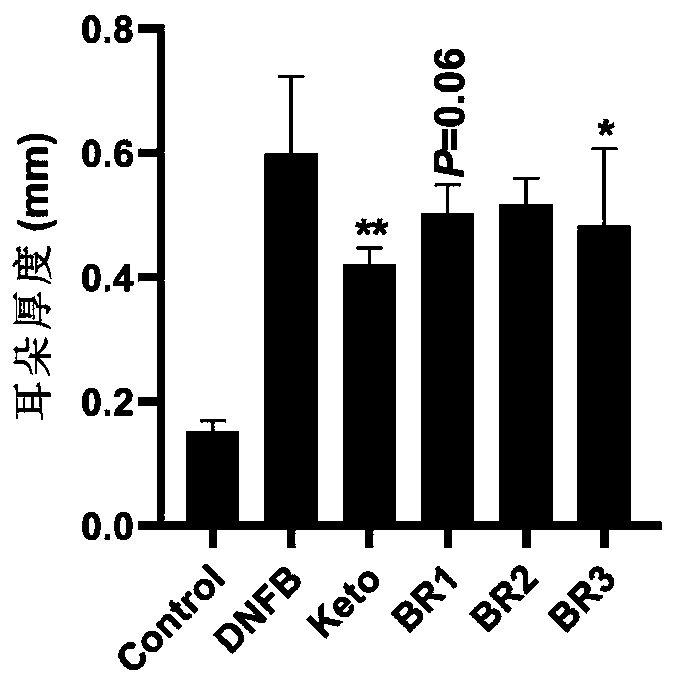 Bifidobacterium capable of relieving atopic dermatitis and application of bifidobacterium