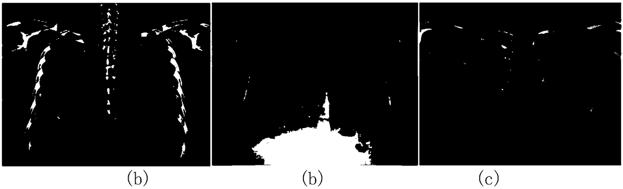 A method for detecting motion artifact regions based on the gradient correlation of bone images and soft tissue images in dual-energy subtraction