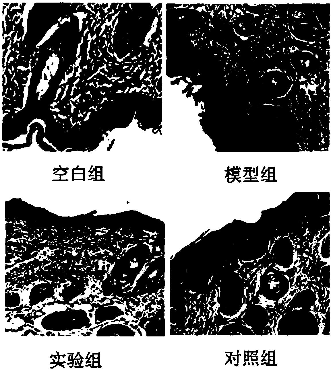 Dressing used for alleviating psoriasis, and preparation method thereof