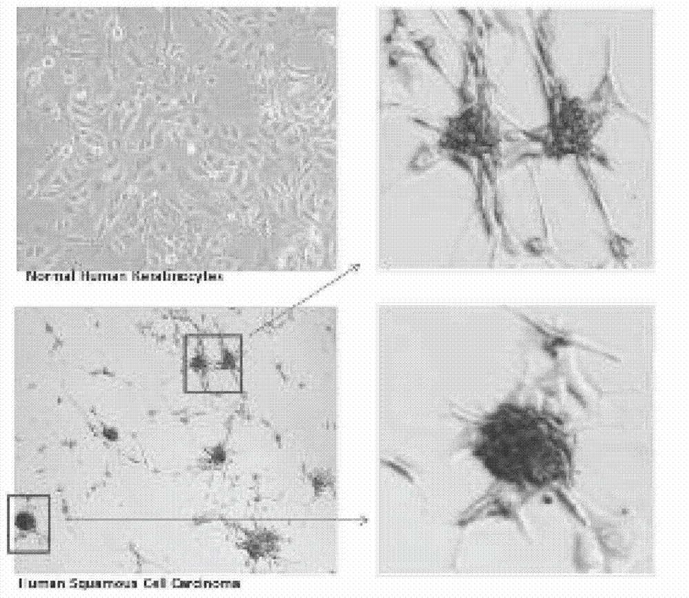 Animal model establishment method of human primary skin squamous epithelial cell cancer stem cell