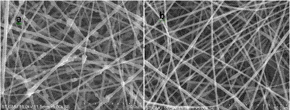 Bifunctional novel periodontal guided tissue regeneration membrane with sandwich structure and preparation method thereof and application