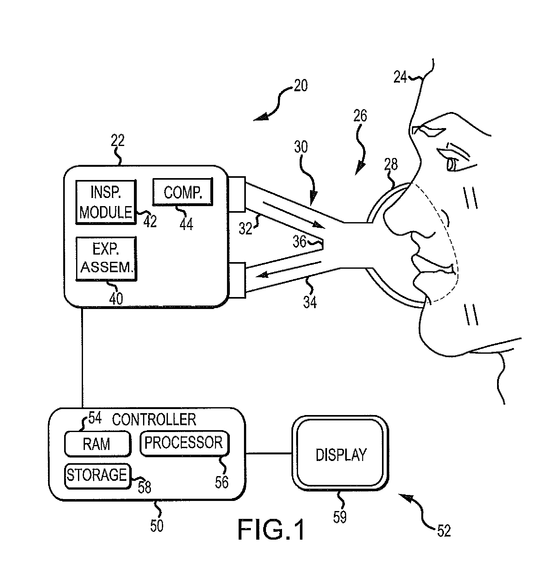 Exhalation Valve Assembly With Integral Flow Sensor