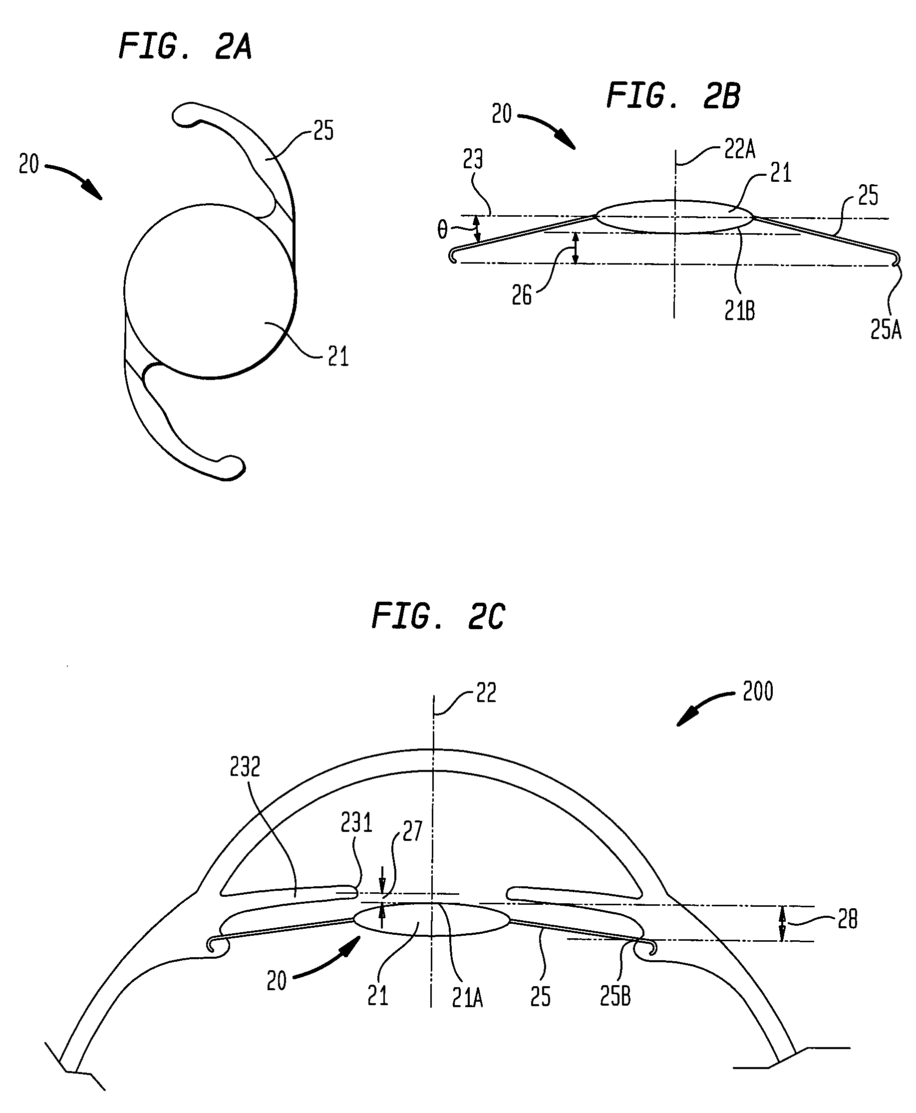 Ocular implant to correct dysphotopsia, glare, halos and dark shadow type phenomena