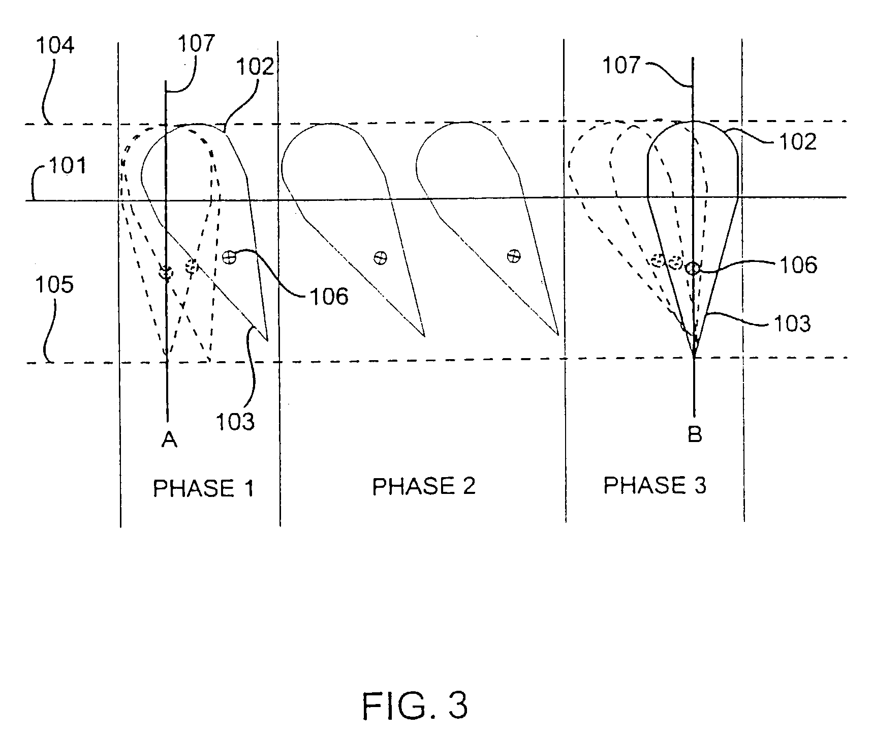 System and method for producing tooth movement