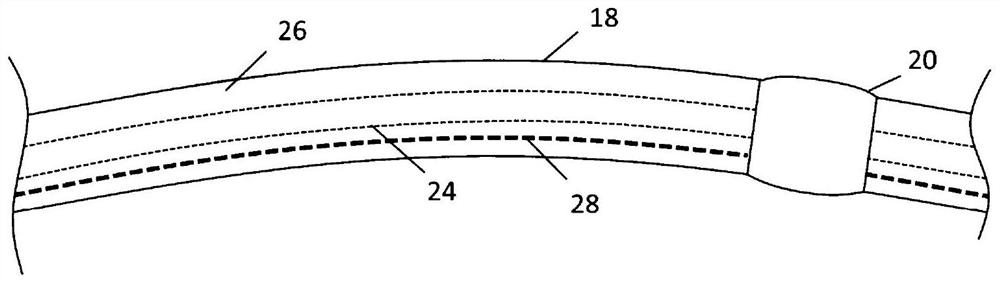 Basket conduit with pre-strained frame