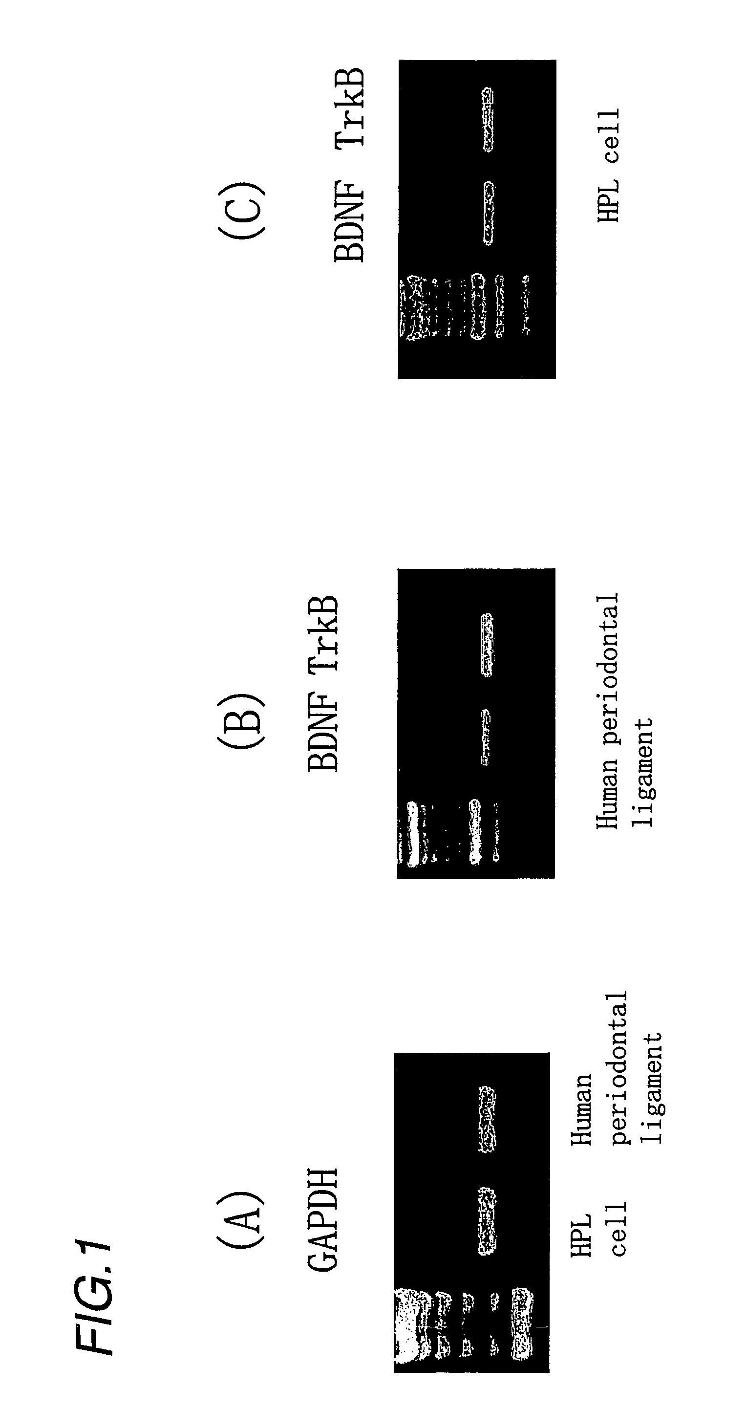 Therapeutic agent and therapeutic method for periodontal diseases and pulpal diseases