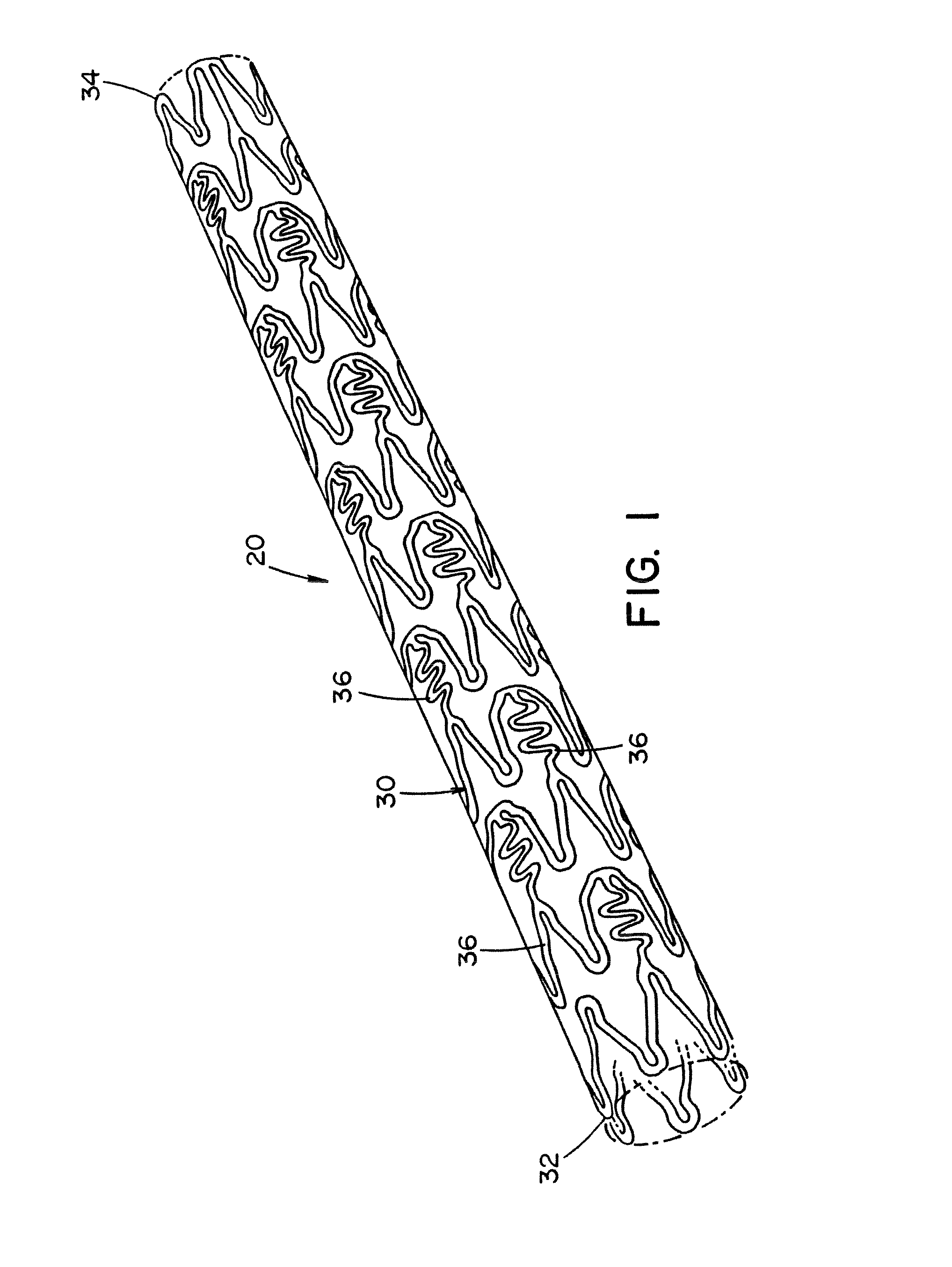 Method for forming a tubular medical device