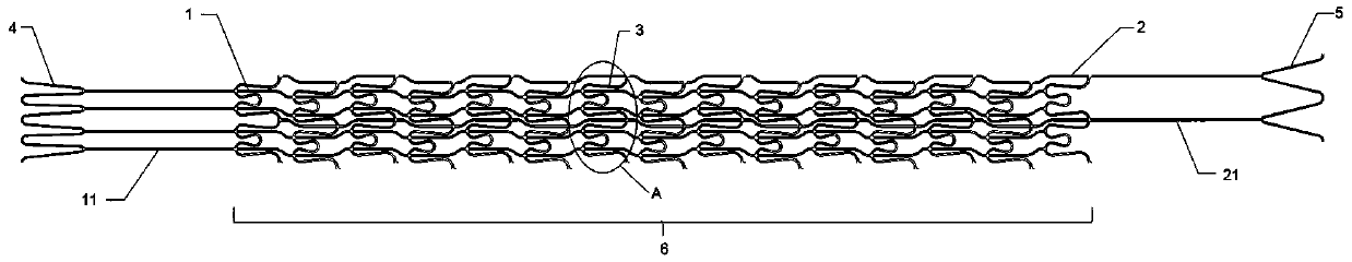 Distal and proximal asymmetric balloon restraint stent and high-stability balloon catheter with restraint stent