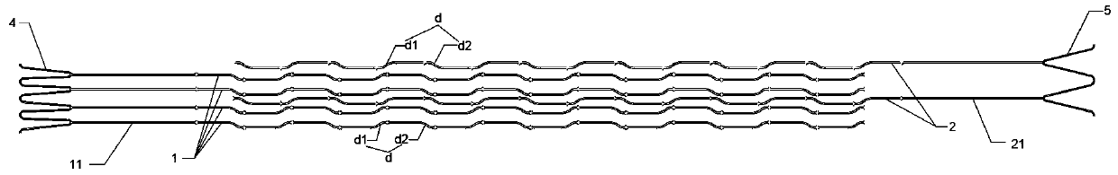 Distal and proximal asymmetric balloon restraint stent and high-stability balloon catheter with restraint stent