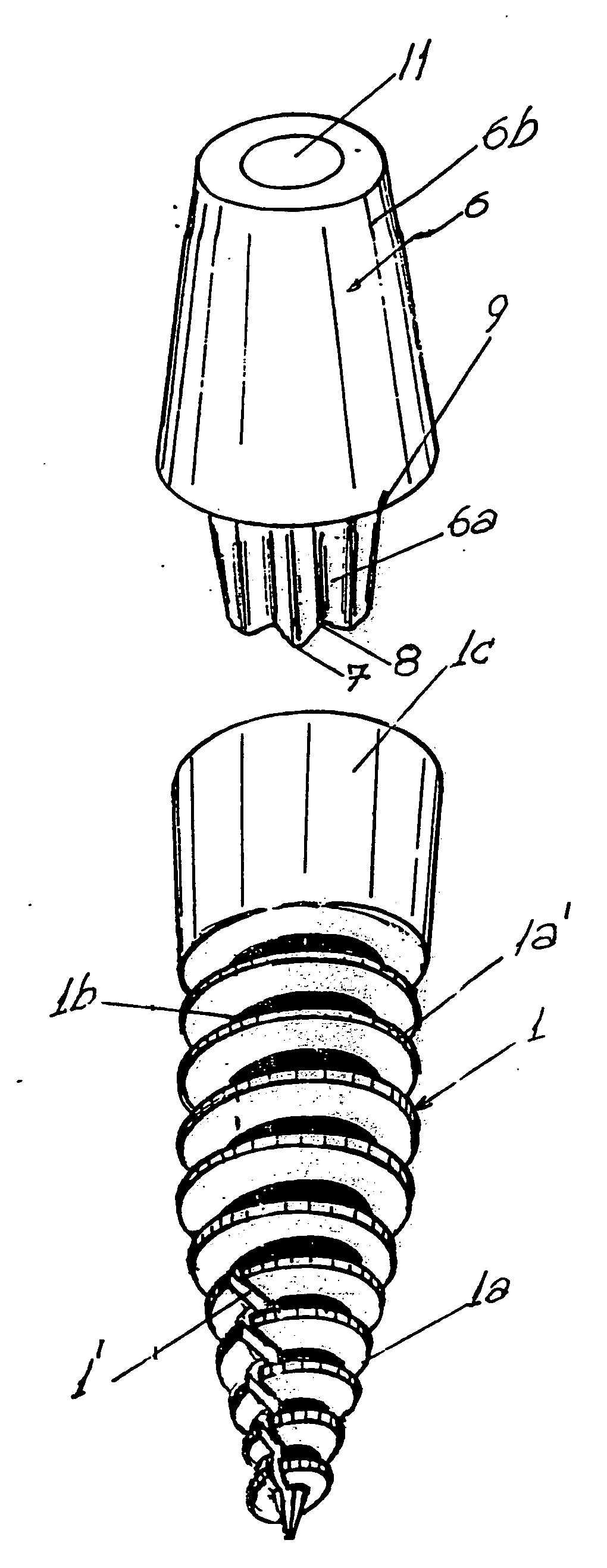 Dental implants intergrated into the bone to sustain a dental prosthesis