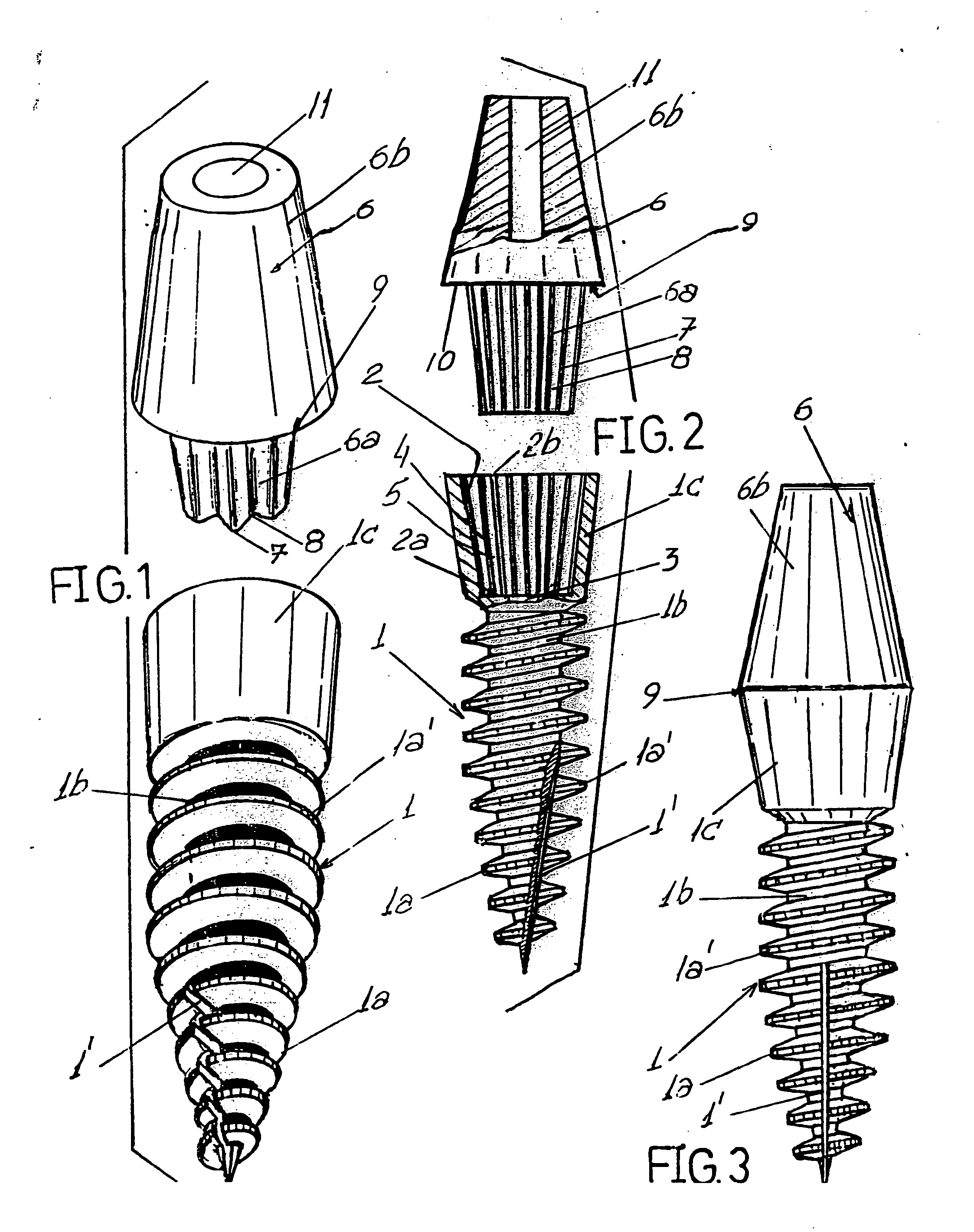 Dental implants intergrated into the bone to sustain a dental prosthesis