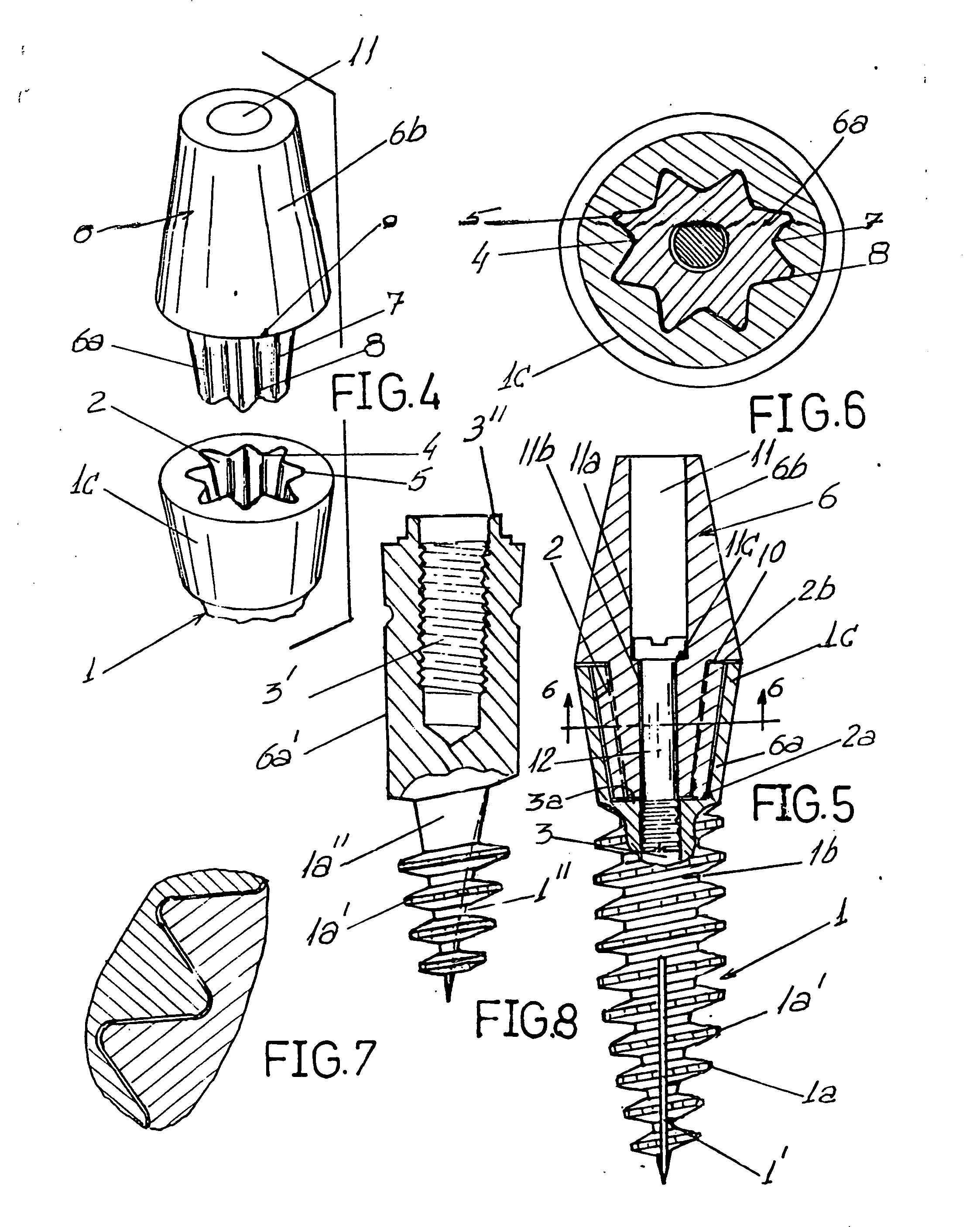 Dental implants intergrated into the bone to sustain a dental prosthesis