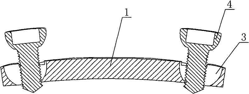 Rotation and anti-regression anterior cervical internal fixation device