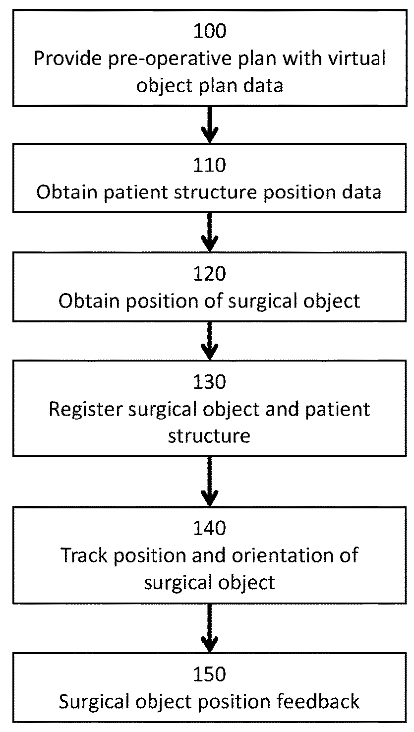 Method and system for computer assisted surgery